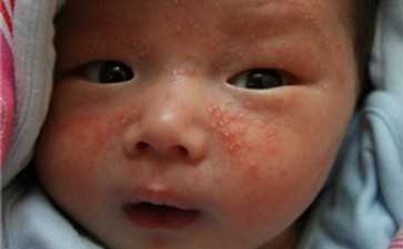 孕酮低怎么调理才好？孕酮低吃什么可以补？-找靠谱代妈