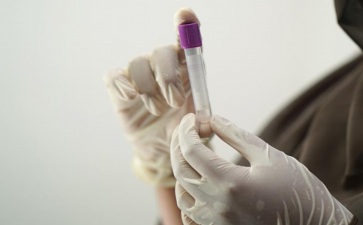 试管婴儿促排时卵巢反应低怎么办？促排期间卵巢反应低的因素...-捐卵机构电话