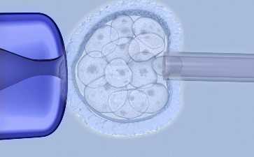 做试管婴儿取精取卵的时分痛不痛苦-人工代怀