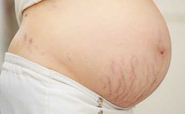 佛山三代试管的优势和劣势-助孕机构招聘官网