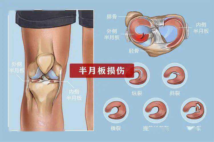 4人得以重见光明：大阪大学首次利用iPS再生组织修复LSCD患者角膜